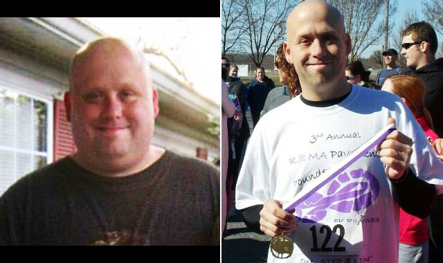 Brian R Before and After