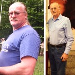 Thomas Beatty Before and After